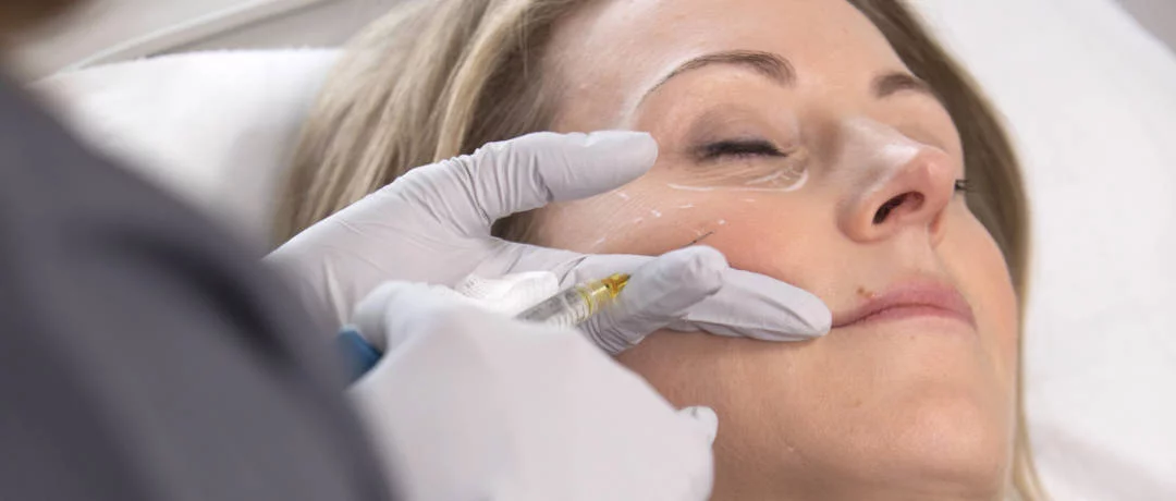 a patient having polynucleotide treatment in london at the waterhouse young clinic